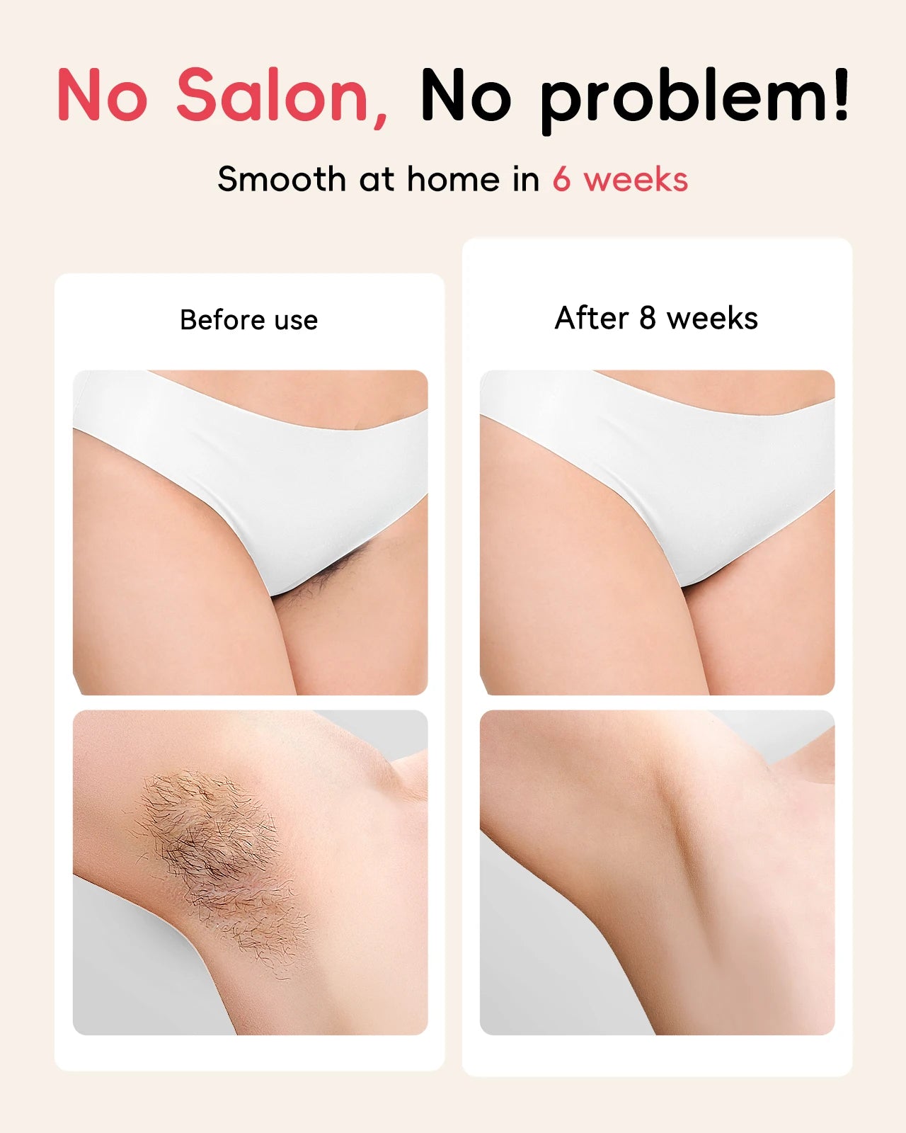 SmoothSkin Laser Hair Remover